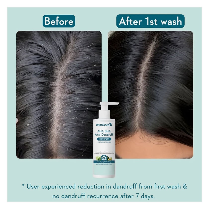WishCare AHA BHA Anti-Dandruff Hydrating Shampoo 250ml