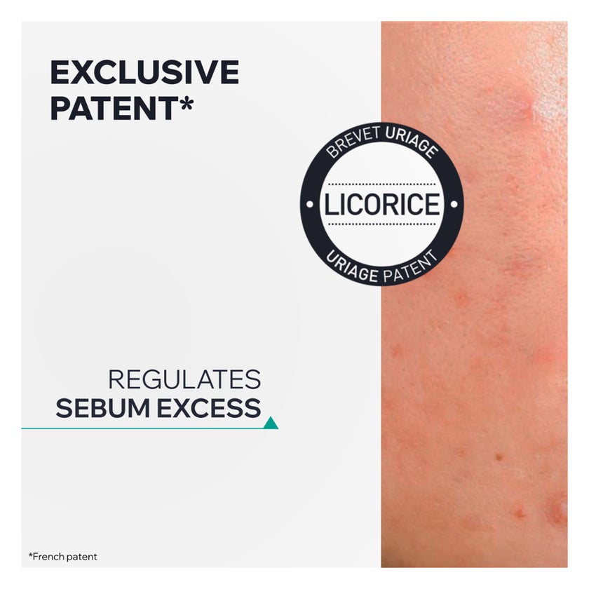 Uriage Hyseac SOS Drying Gel, Blemish & Dark Spots - 15ml