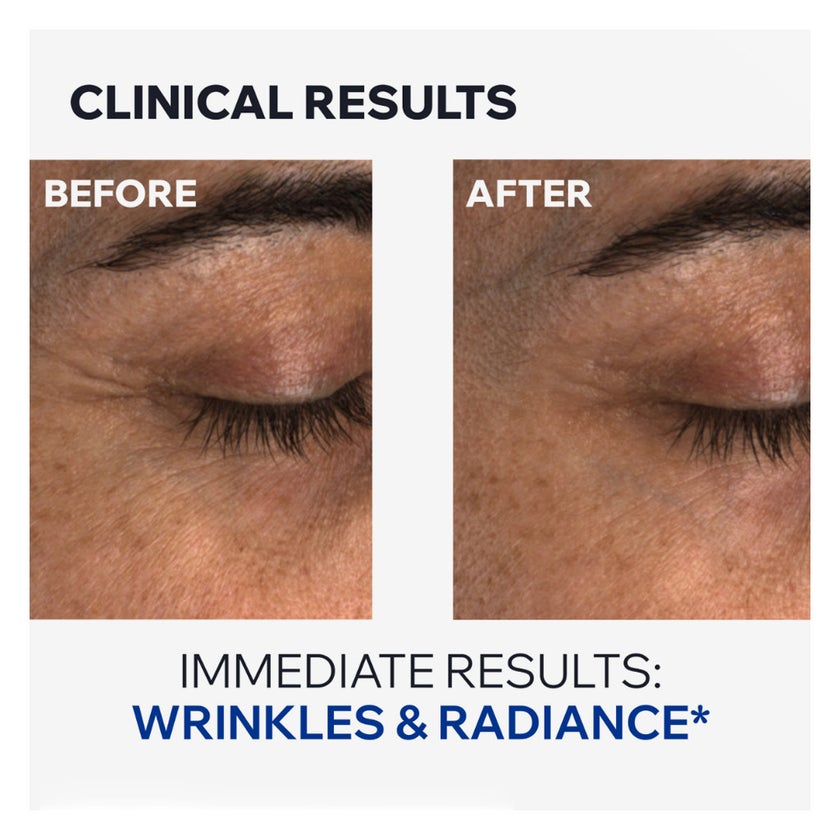 Uriage Age Absolu Blur-Redensifying Eye Contour Balm 15ml