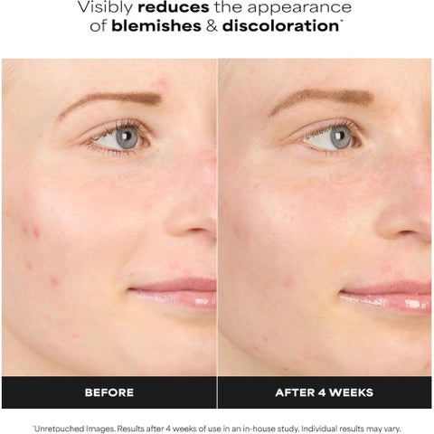 Paula's Choice 10% Azelaic Acid Booster Cream - 30ml