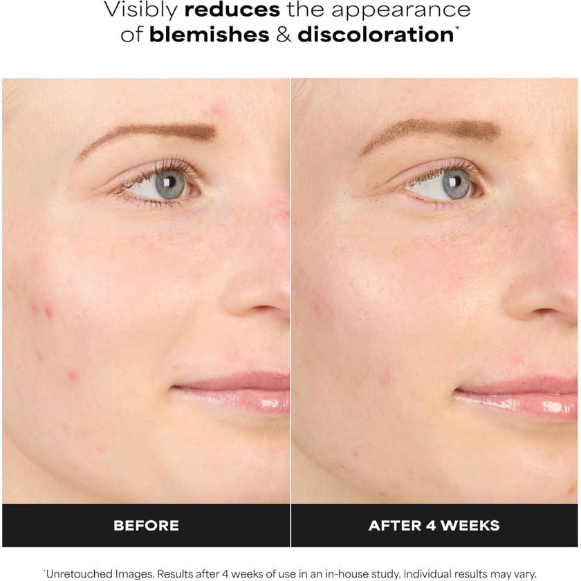 Paula's Choice 10% Azelaic Acid Booster Cream - 30ml