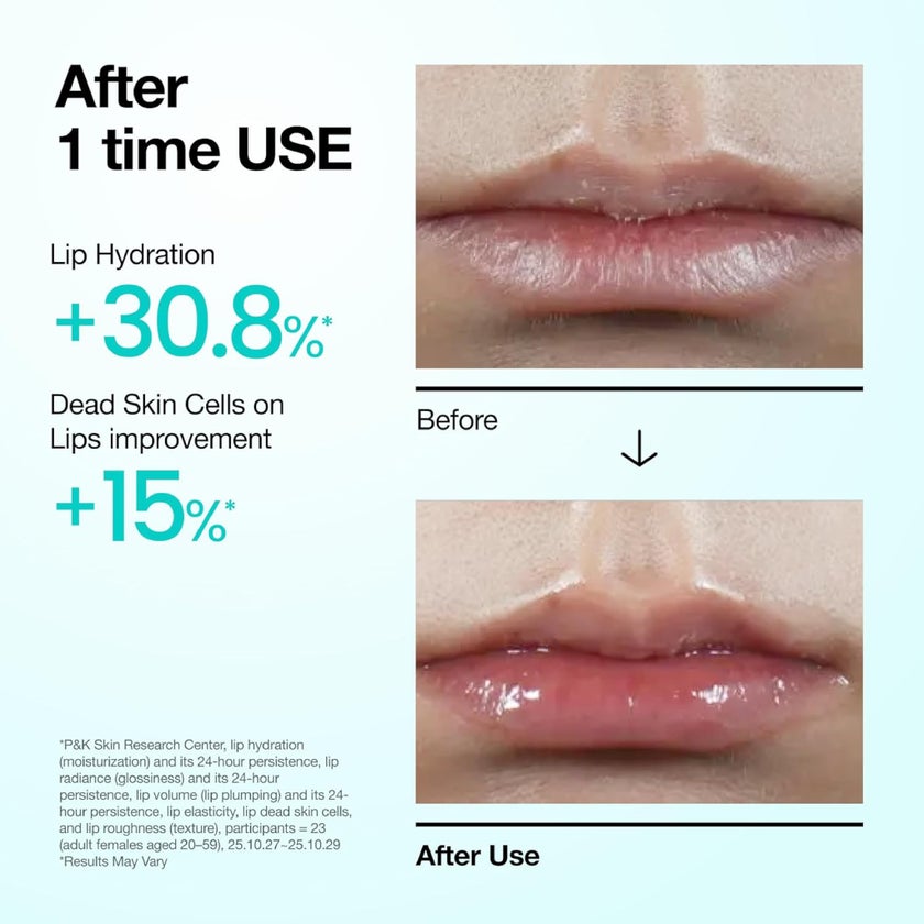 Anua PDRN Lip Serum - 10ml