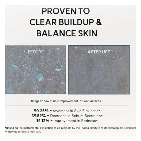 Arencia Eraser Shot Glycolic Acid Booster, Blemish Control - 30ml