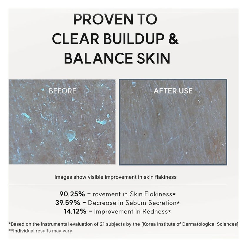 Arencia Eraser Shot Glycolic Acid Booster, Blemish Control - 30ml