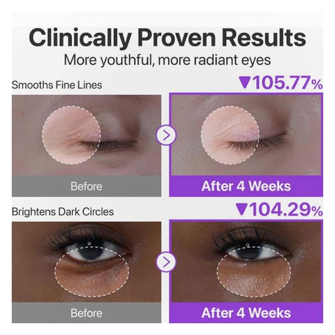 Numbizin No. 9 NAD+ Retinol Volumetox Eye Cream - 10ml