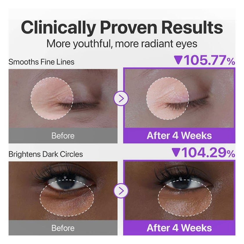 Numbizin No. 9 NAD+ Retinol Volumetox Eye Cream - 10ml