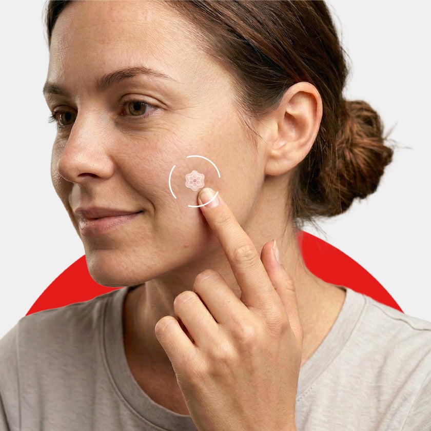 Elle Magnesium Acne Micro-Dart Patches, 12mm - 10 Patches
