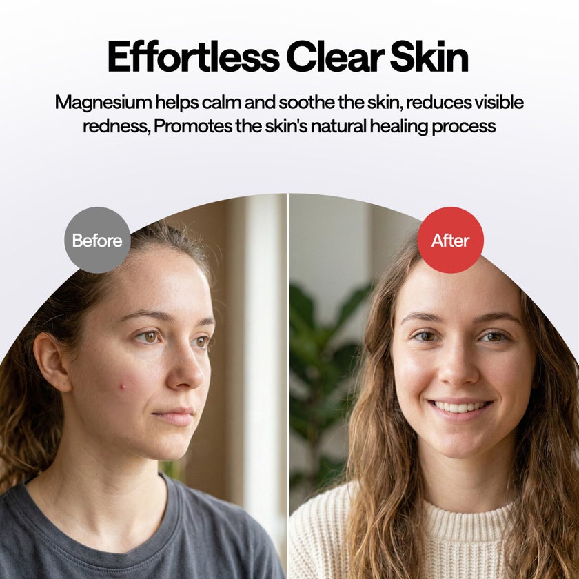 Elle Magnesium Acne Micro-Dart Patches, 12mm - 10 Patches