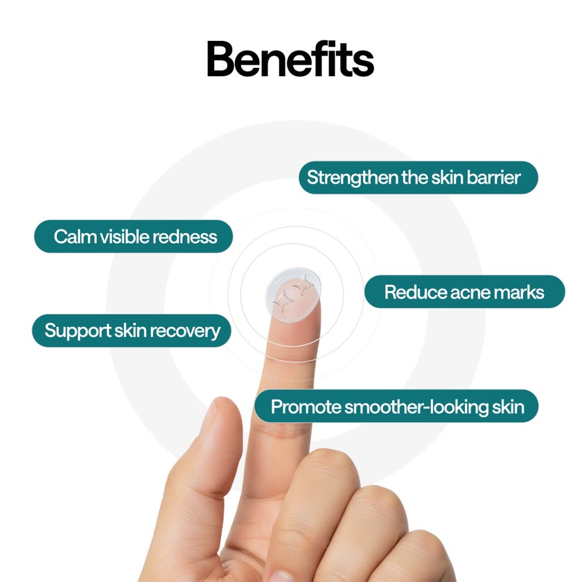 Elle Magnesium Acne Patches, 11mm & 10mm - 45 Patches