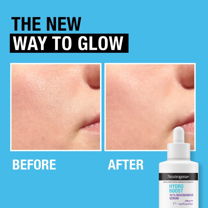 Neutrogena Hydro Boost 10% Niacinamide Serum, Hyaluronic Acid - 30ml