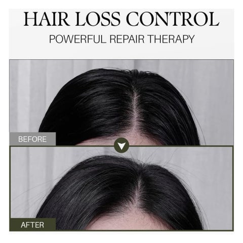D'Alba Professional Scalp Therapy Serum Shampoo - 275ml
