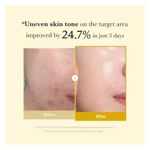 Medicube Kojic Acid Turmeric Night Wrapping Face Mask - 75ml