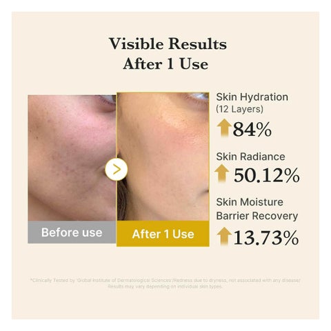 Medicube Kojic Acid Turmeric Vita Jelly Mist Serum - 100ml