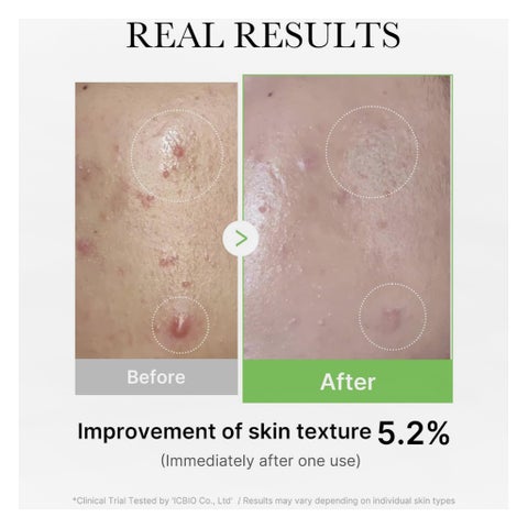 Medicube Exosome Cica Serum - 30ml