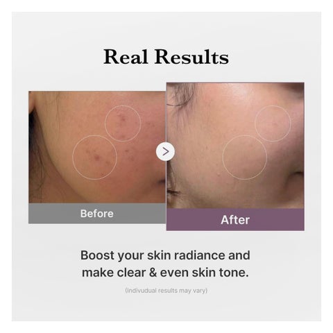 Medicube Age-R Glutathione Glow Toner - 140ml