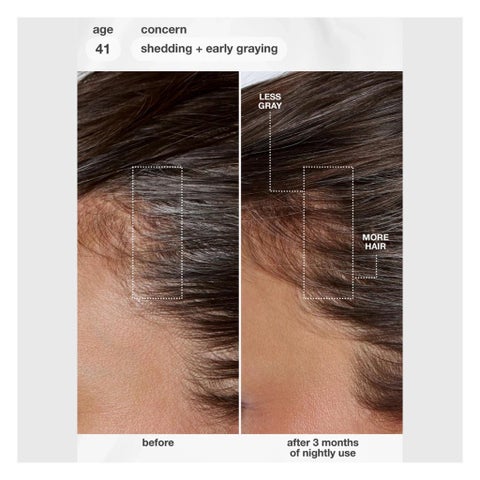 K18 Future IQ Biomimetic Hair Longevity Serum - 90ml