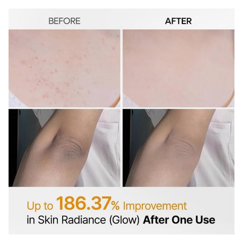 Dr. Melaxin Peel Shot Exfoliating Kojic Acid Turmeric Spray - 200ml
