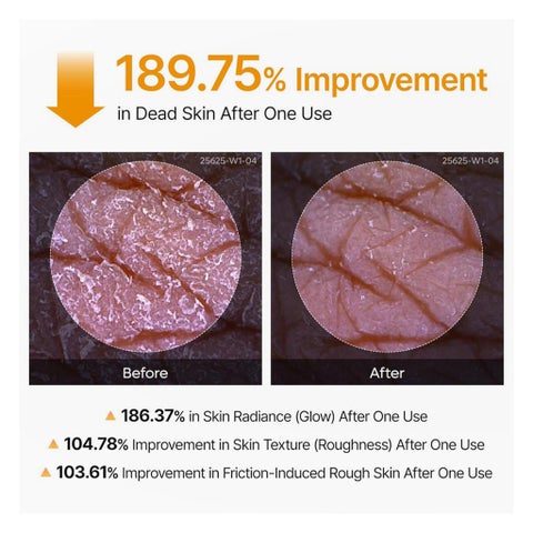 Dr. Melaxin Peel Shot Exfoliating Kojic Acid Turmeric Spray - 200ml