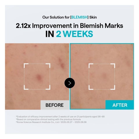 Mediheal Madecassoside Blemish Pads, 170ml - 100 Pads