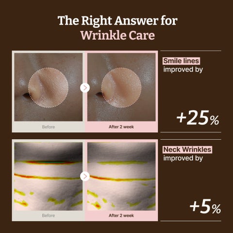 Dr. Reju-All Advanced PDRN Rejuvenating Mask - 4 Masks