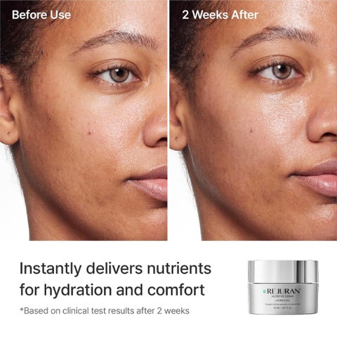 Rejuran C-PDRN 0.2% Nutritive Cream - 50ml
