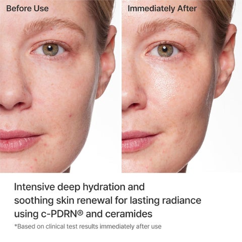 Rejuran C-PDRN Turnover Mask - 5 Sheets