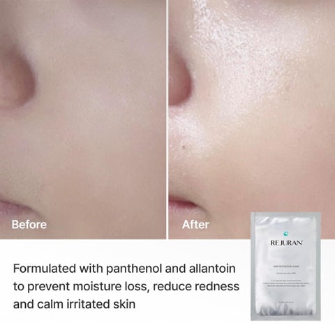 Rejuran C-PDRN Skin Protection Mask - 5 Sheets