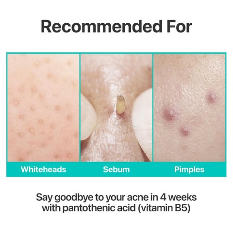 Numbuzin No.1 Pantothenic B5 Active Soothing Cream - 80ml